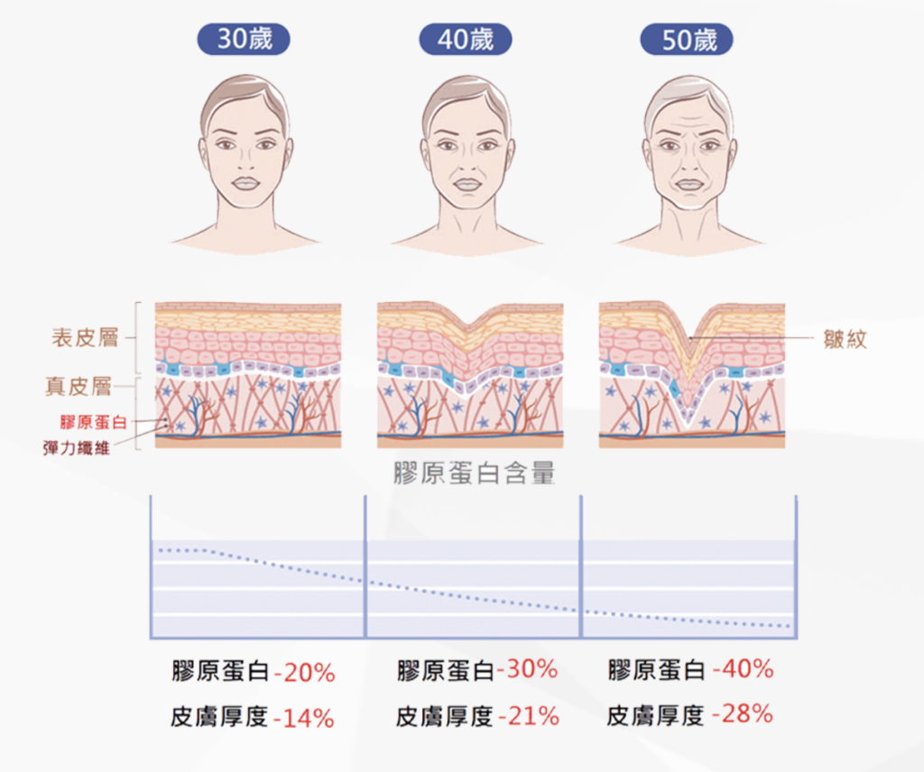 膠原蛋白流失圖