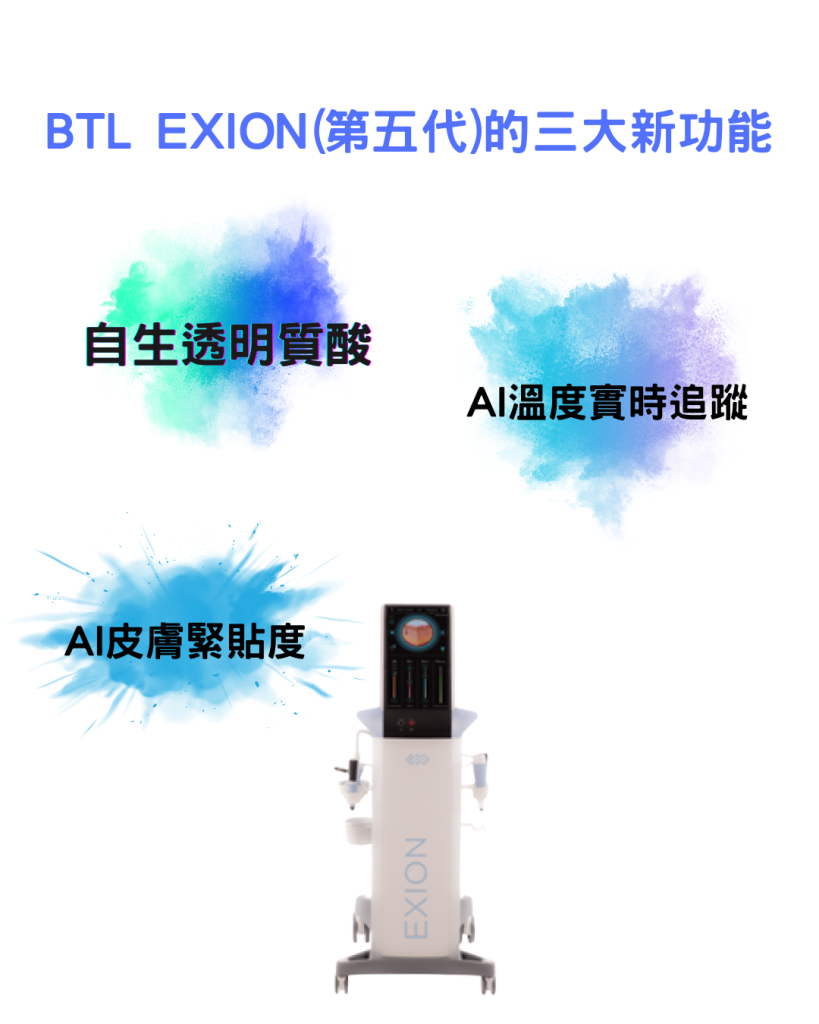 BTL exion新功能