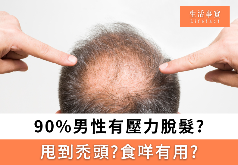 男士脫髮治療