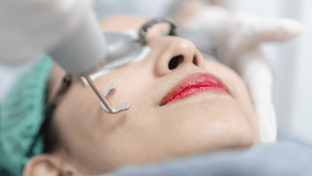 荷爾蒙斑會自動消退嗎