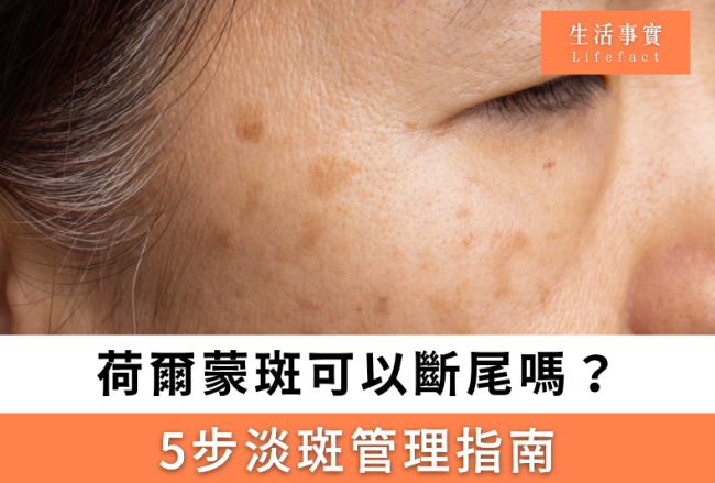 荷爾蒙斑可以斷尾嗎