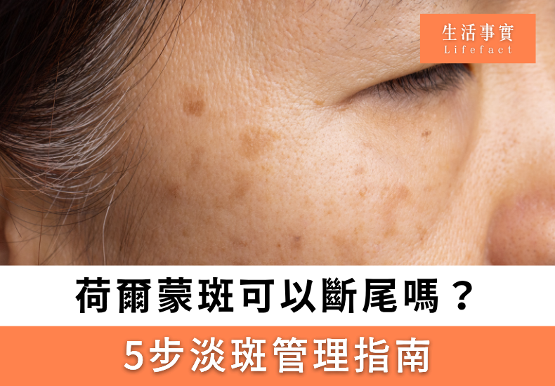 荷爾蒙斑可以斷尾嗎