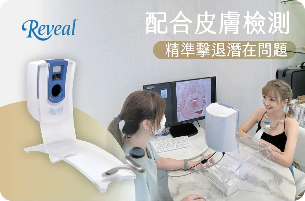荷爾蒙斑皮膚分析Reveal