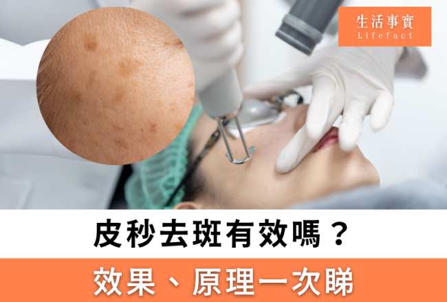 皮秒去斑有效嗎