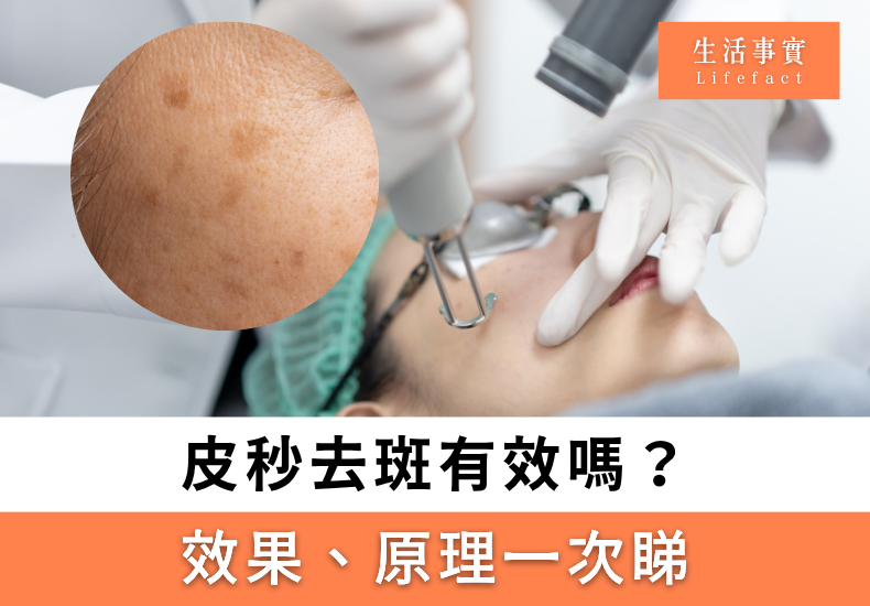 皮秒去斑有效嗎