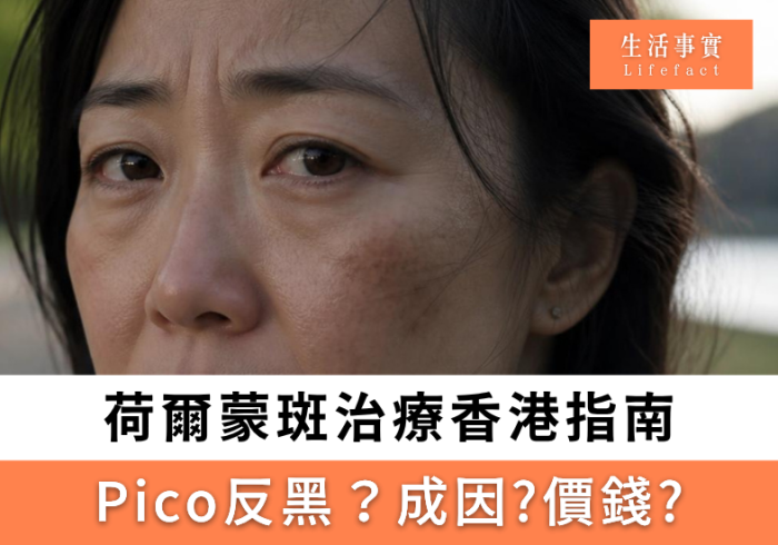 荷爾蒙斑治療香港指南