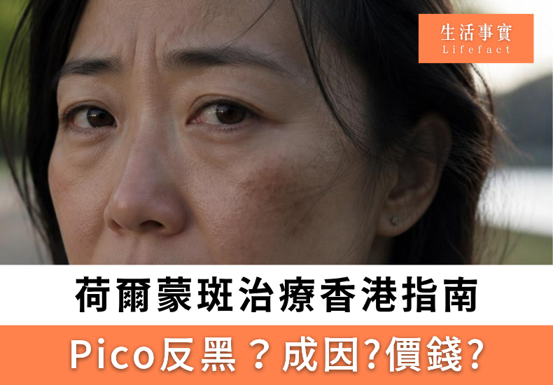 荷爾蒙斑治療香港指南