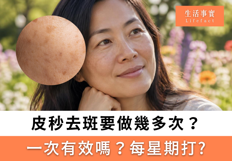 皮秒去斑有效嗎