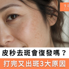 皮秒反黑幾耐退