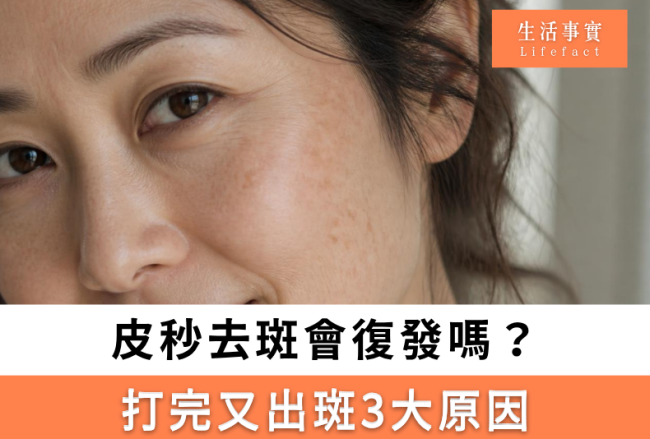 皮秒反黑幾耐退