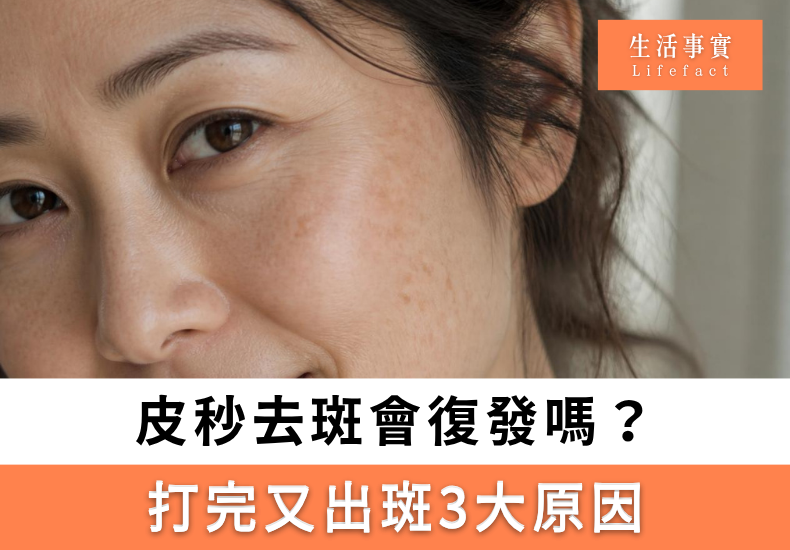 皮秒反黑幾耐退