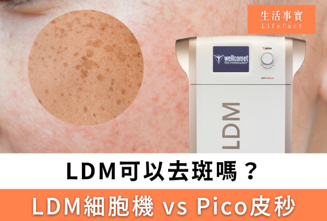 LDM可以去斑嗎
