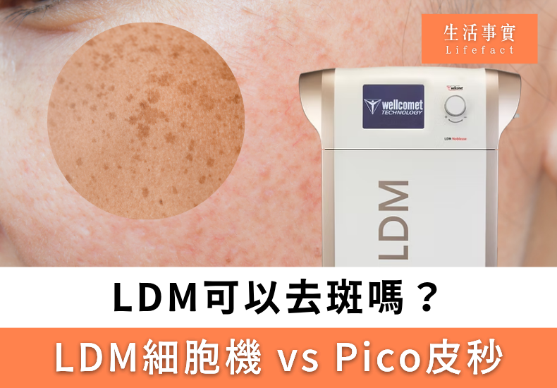 LDM可以去斑嗎