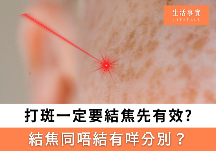 打斑結焦先有效