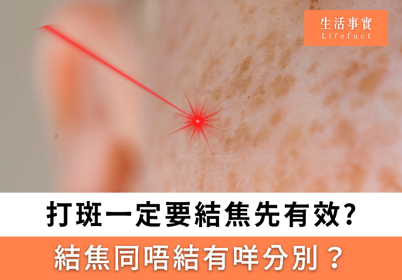 打斑結焦先有效